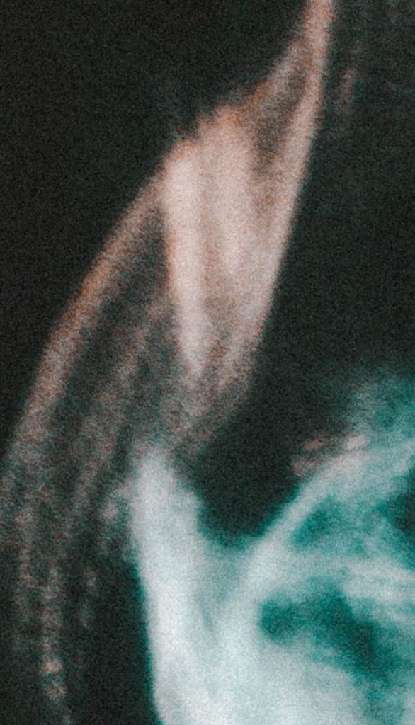 BURNING BEN (SAMPLE)